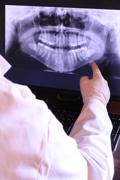 Best Emergency Dental Extractions in Merritt Park, NY