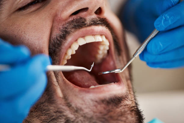 Best Orthodontic Emergency Dentist in Merritt Park, NY